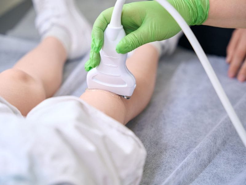 Ecografie musculo-scheletală la copii în Craiova – evaluare precisă